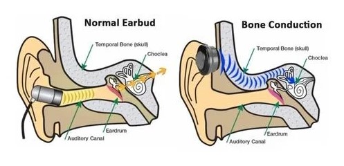 How does bone congestion technology work